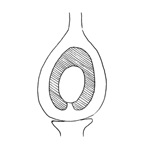 Basal placentation:|:基生胎座:|:基生胎座
